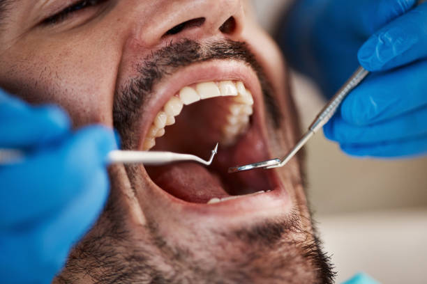 Emergency Dental Services in Port Ludlow, WA