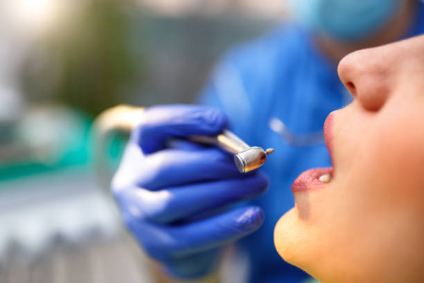 Dental Bonding in Port Ludlow, WA